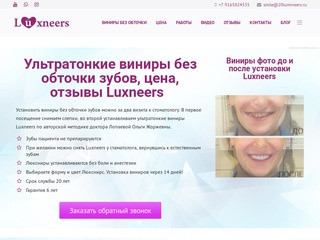 Виниры без обточки зубов, цена за 1 зуб в Москве, отзывы, фото