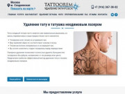 Удаление татуировок. Удаление тату/татуажа лазером в Москве