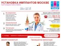 Импланты в Москве